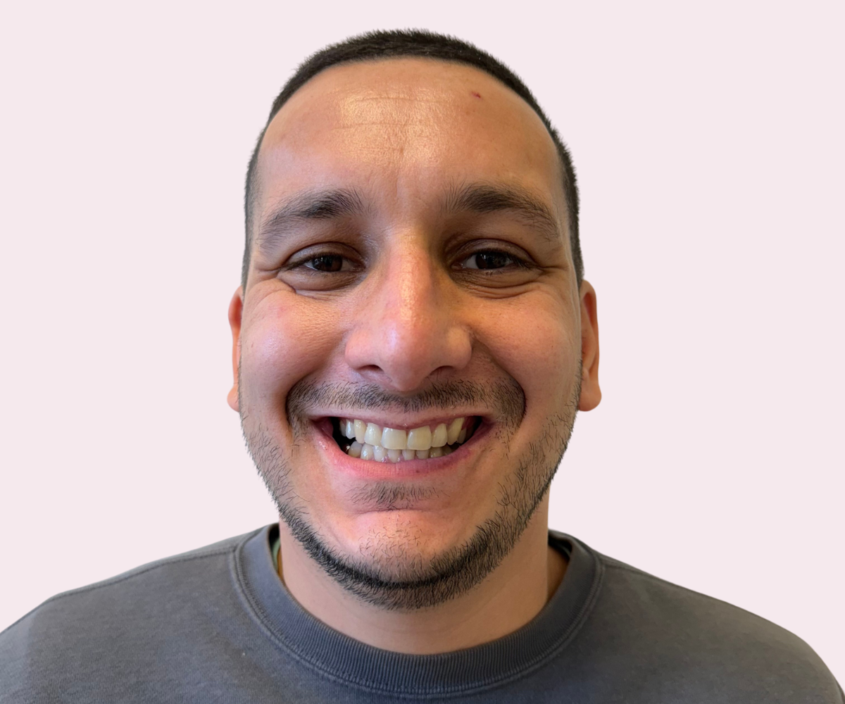 Smile transformations: Before and afters - Hampshire Dentists Pain Free Dentist in Southampton