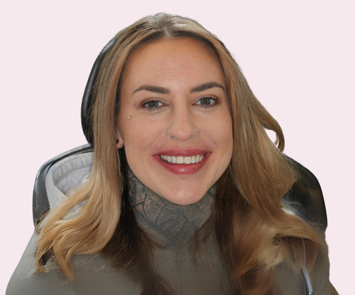 Smile transformations: Before and afters - Hampshire Dentists Pain Free Dentist in Southampton