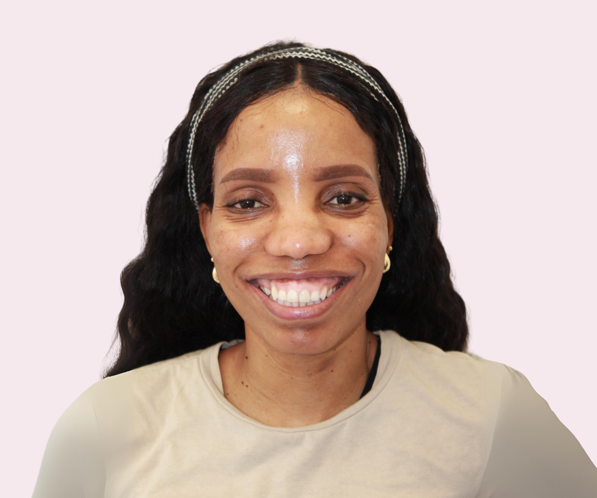 Smile transformations: Before and afters - Hampshire Dentists Pain Free Dentist in Southampton
