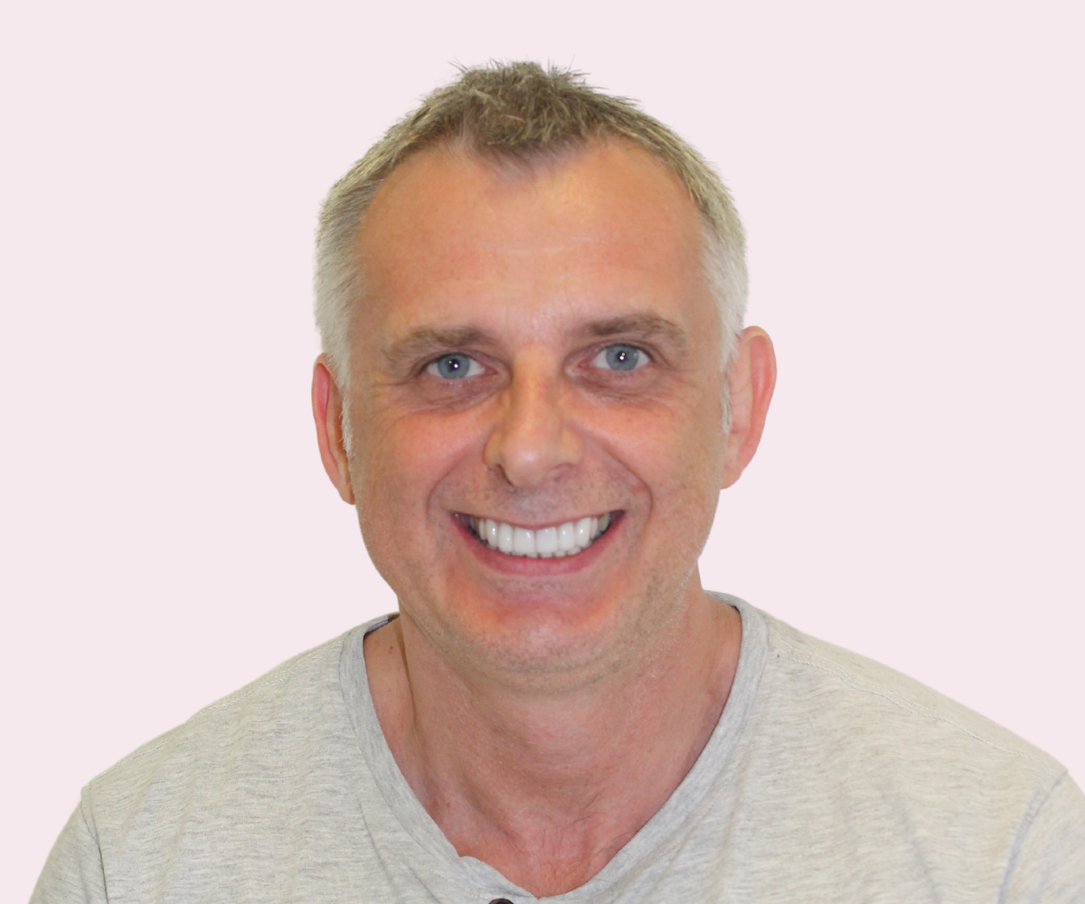 Smile transformations: Before and afters - Hampshire Dentists Pain Free Dentist in Southampton