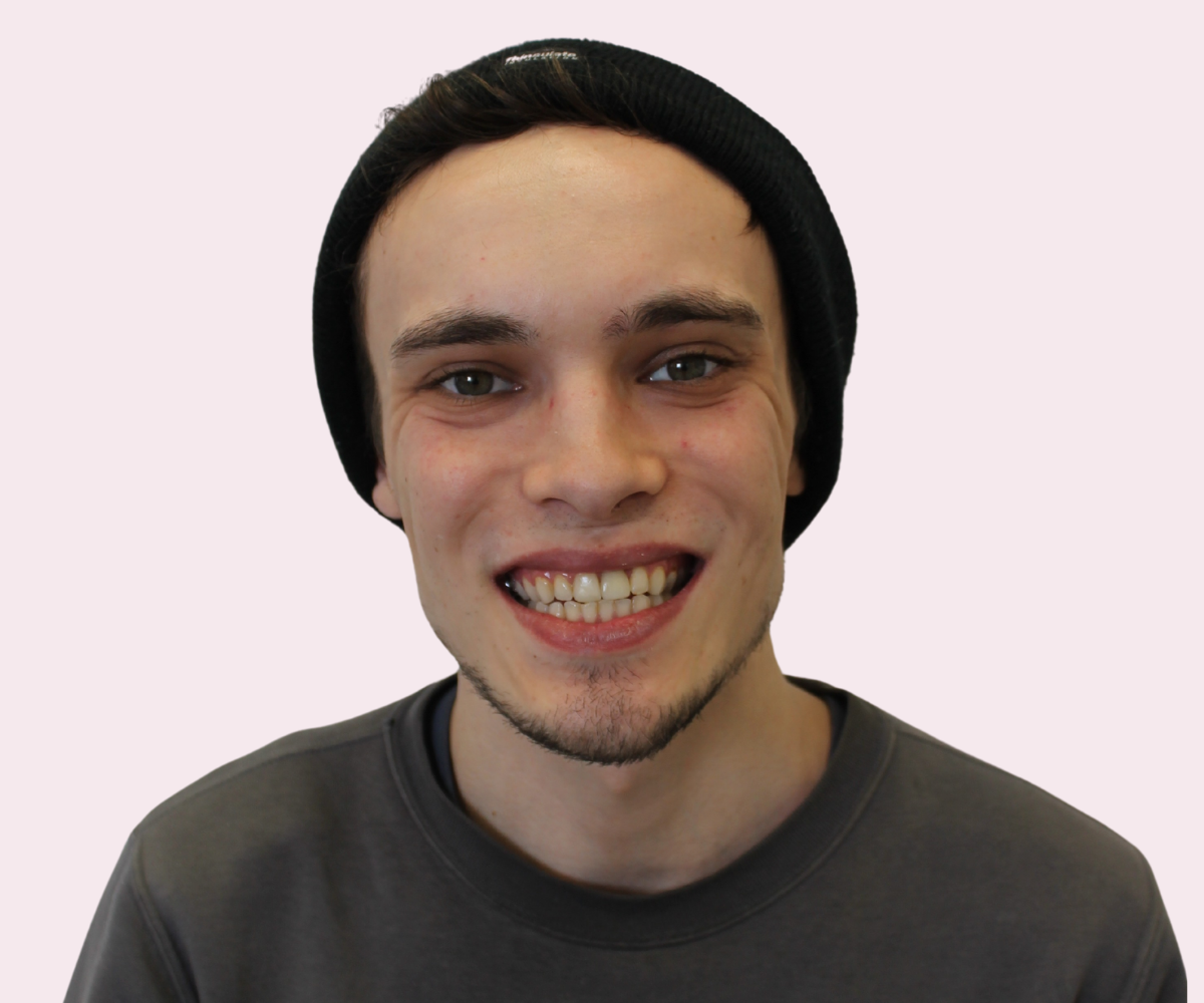 Smile transformations: Before and afters - Hampshire Dentists Pain Free Dentist in Southampton