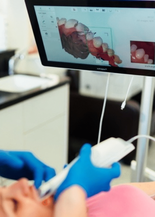 Invisalign - Hampshire Dentists Pain Free Dentist in Southampton Invisalign - Hampshire Dentists Pain Free Dentist in Southampton