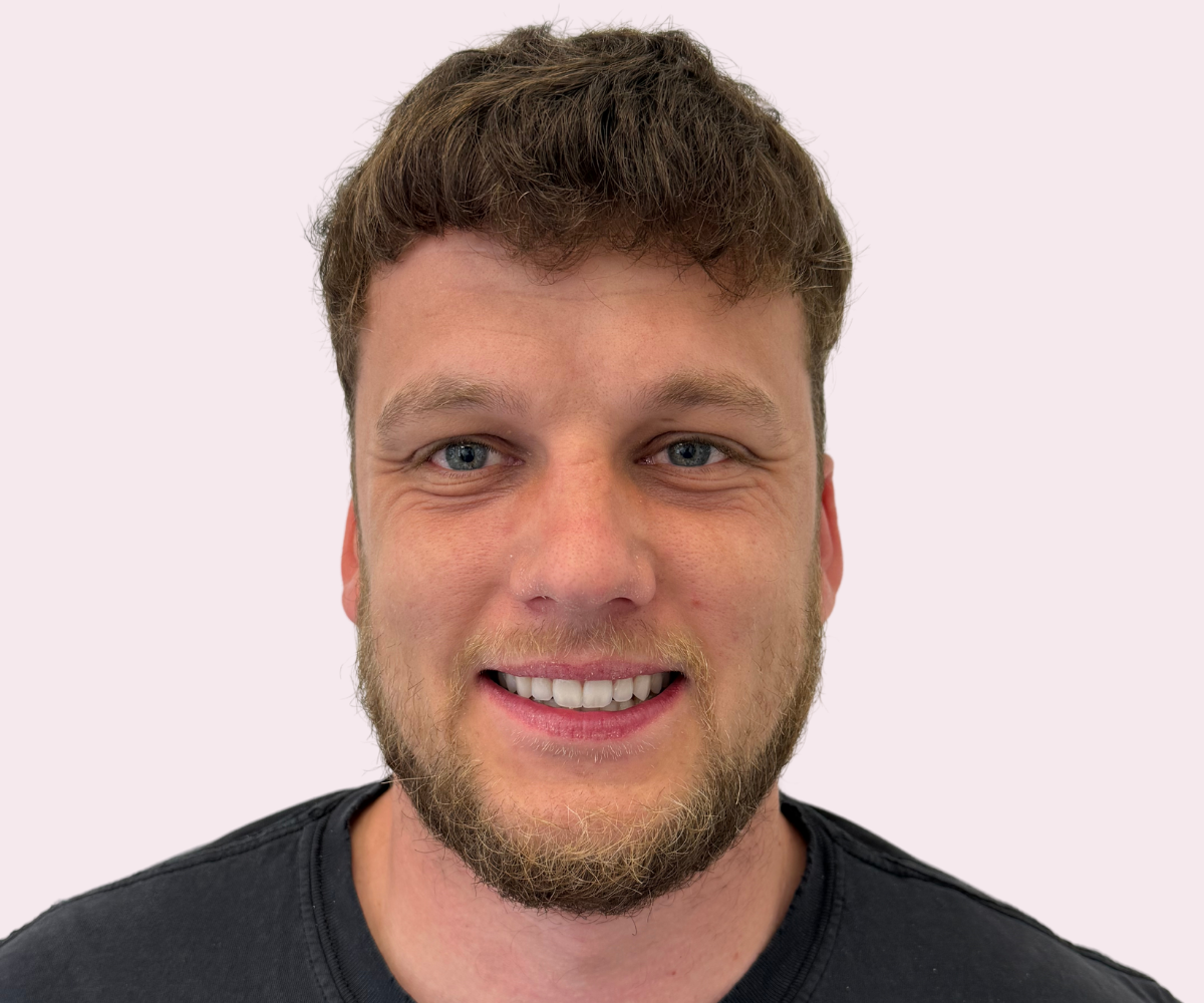 Smile transformations: Before and afters - Hampshire Dentists Pain Free Dentist in Southampton