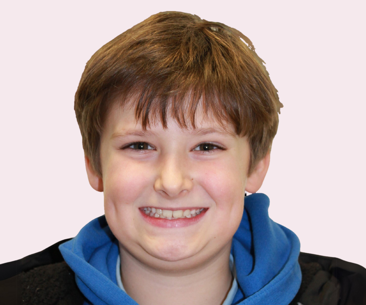 Smile transformations: Before and afters - Hampshire Dentists Pain Free Dentist in Southampton