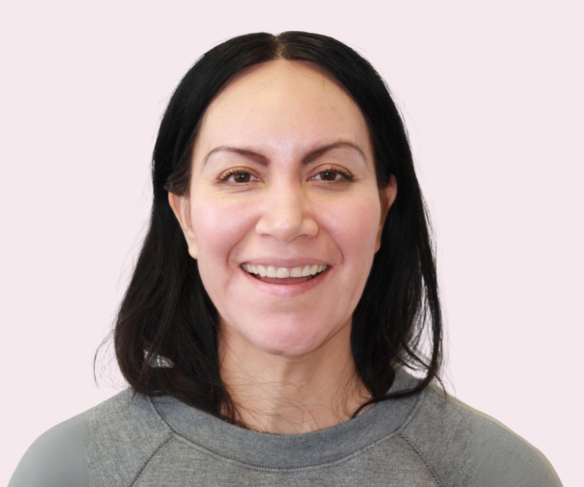 Smile transformations: Before and afters - Hampshire Dentists Pain Free Dentist in Southampton