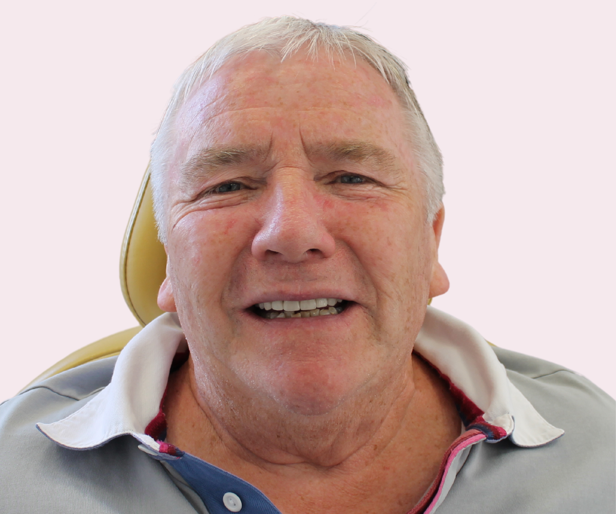 Smile transformations: Before and afters - Hampshire Dentists Pain Free Dentist in Southampton