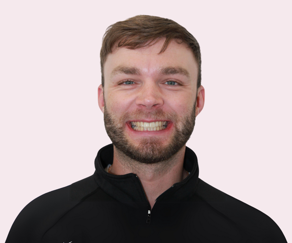 Smile transformations: Before and afters - Hampshire Dentists Pain Free Dentist in Southampton
