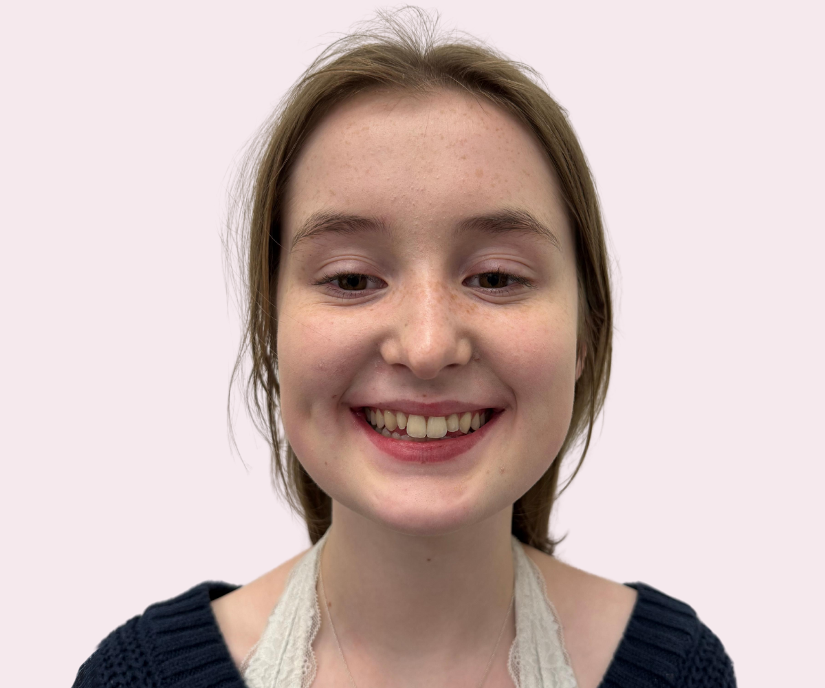 Smile transformations: Before and afters - Hampshire Dentists Pain Free Dentist in Southampton