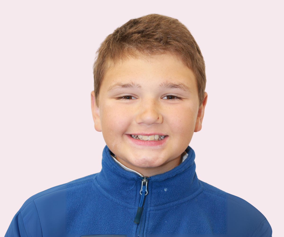 Smile transformations: Before and afters - Hampshire Dentists Pain Free Dentist in Southampton