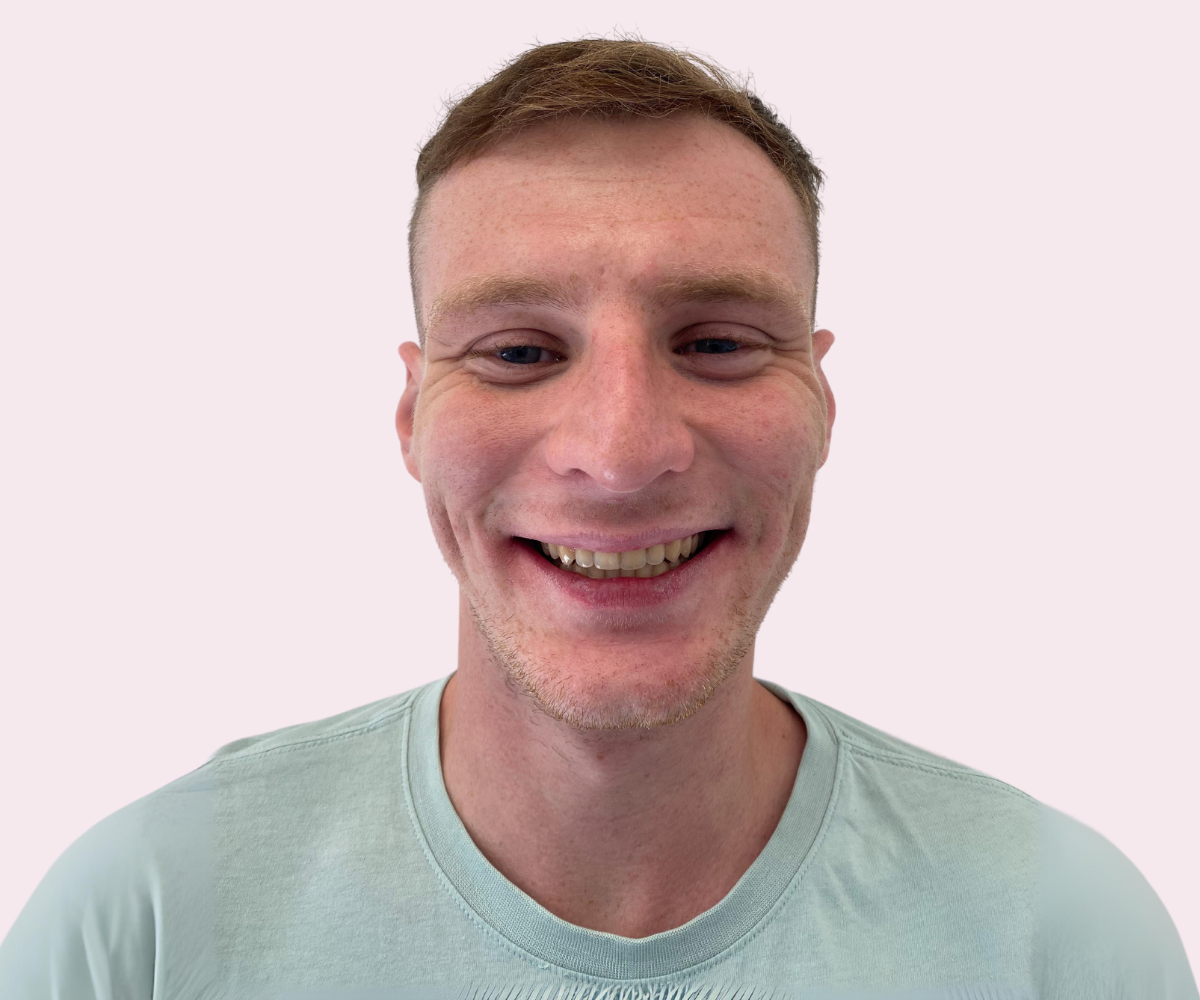 Smile transformations: Before and afters - Hampshire Dentists Pain Free Dentist in Southampton