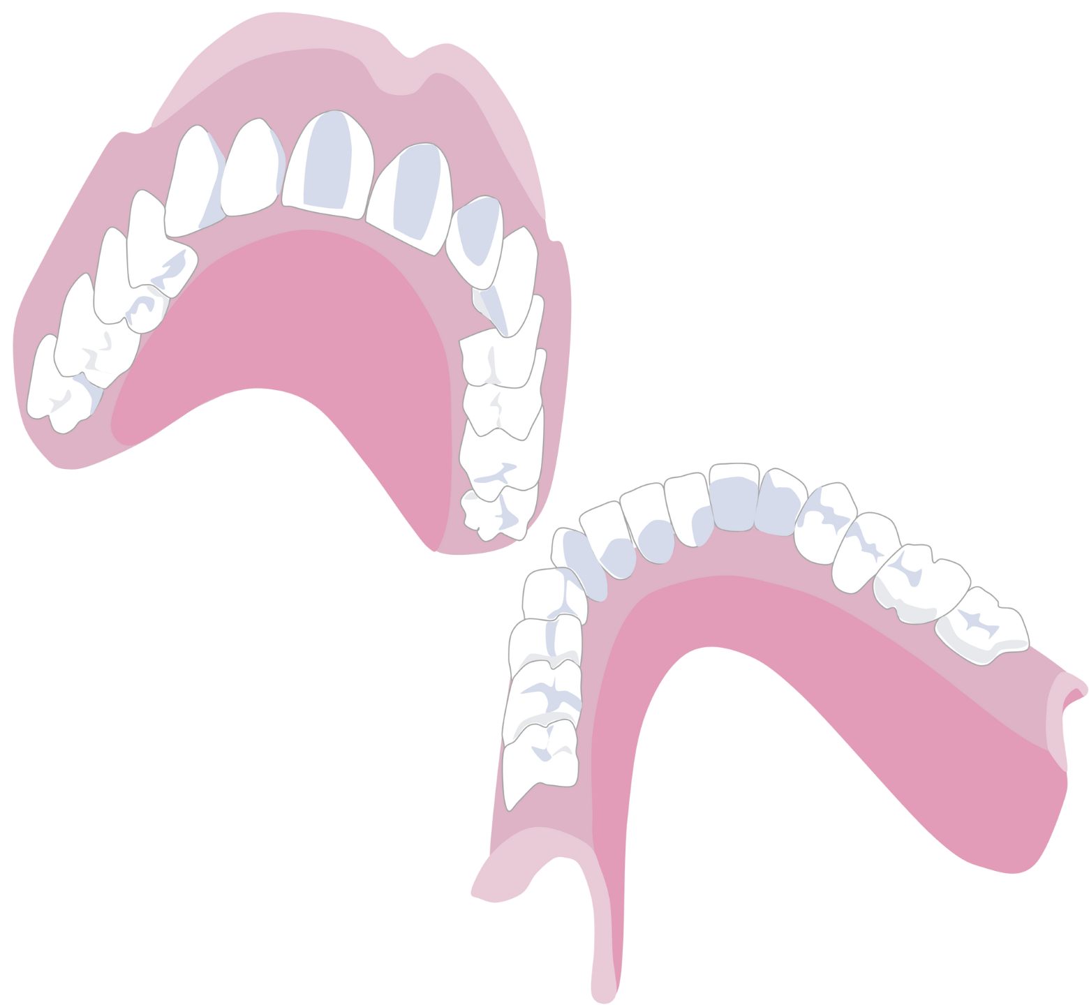 Graphic representation of upper and lower complete denture 