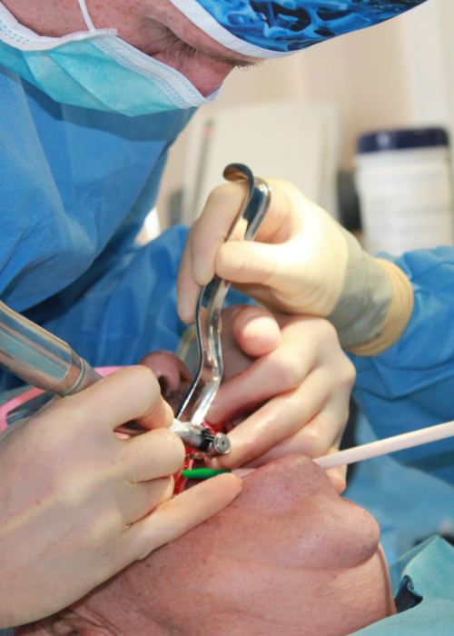 Dr Robin Hanna, supported by dental nurse, mid way through placing dental implant, sowing surgical procedure