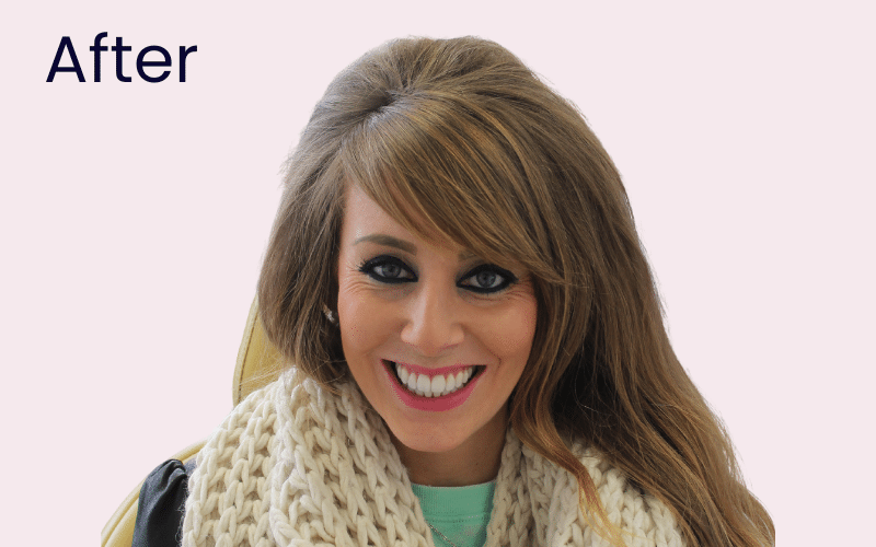 Straight Teeth Options - Hampshire Dentists Pain Free Dentist in Southampton Image of patient after straightening and whitening treatment at Hampshire Dentists in Southampton