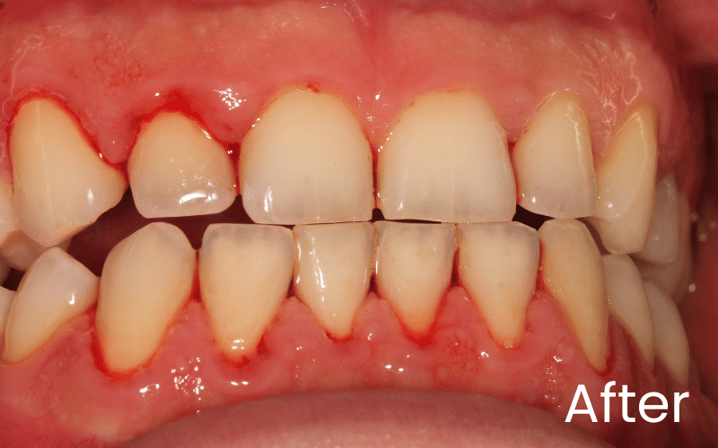Hygienist - Hampshire Dentists Pain Free Dentist in Southampton Hygienist - Hampshire Dentists Pain Free Dentist in Southampton