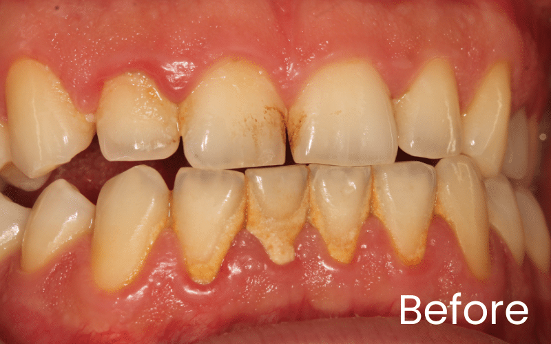 Hygienist - Hampshire Dentists Pain Free Dentist in Southampton Hygienist - Hampshire Dentists Pain Free Dentist in Southampton
