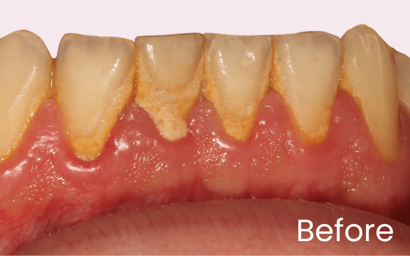 Hygienist - Hampshire Dentists Pain Free Dentist in Southampton Hygienist - Hampshire Dentists Pain Free Dentist in Southampton