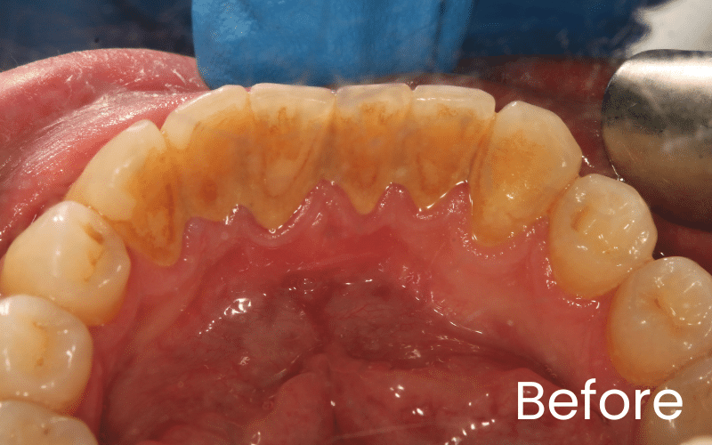 Hygienist - Hampshire Dentists Pain Free Dentist in Southampton Hygienist - Hampshire Dentists Pain Free Dentist in Southampton