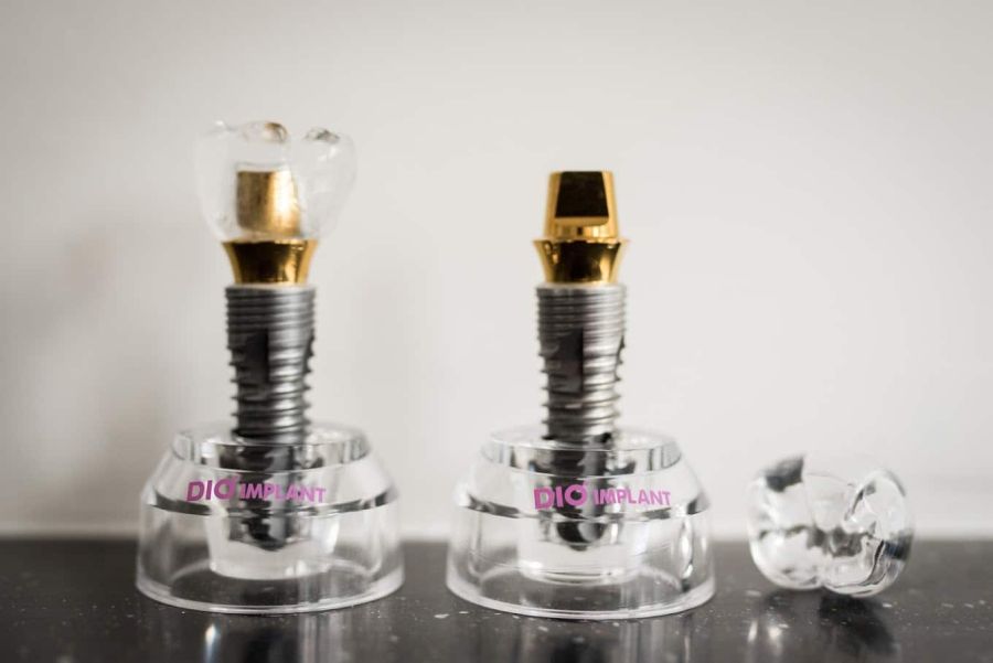 Dental Implant Myths Debunked — Expert Advice from Hampshire Dentists in Southampton - Hampshire Dentists Pain Free Dentist in Southampton Dental Implant Myths Debunked — Expert Advice from Hampshire Dentists in Southampton - Hampshire Dentists Pain Free Dentist in Southampton