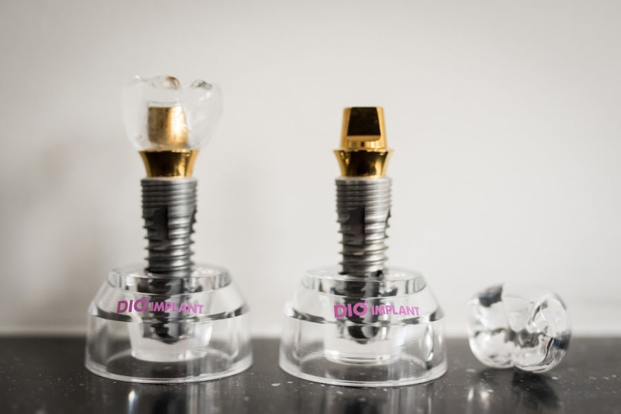 Dental Implant Myths Debunked — Expert Advice from Hampshire Dentists in Southampton - Hampshire Dentists Pain Free Dentist in Southampton Dental Implant Myths Debunked — Expert Advice from Hampshire Dentists in Southampton - Hampshire Dentists Pain Free Dentist in Southampton
