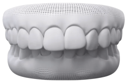Children’s Braces - Hampshire Dentists Pain Free Dentist in Southampton A 3D model of teeth illustrating an example of teeth showcasing an overbite condition.