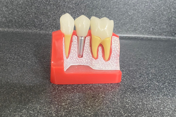 Why you shouldn’t ignore a toothache - Hampshire Dentists Pain Free Dentist in Southampton Why you shouldn’t ignore a toothache - Hampshire Dentists Pain Free Dentist in Southampton