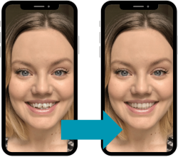 Invisalign - Hampshire Dentists Pain Free Dentist in Southampton Computer generated simulated transformation of smile with Invisalign Smileview on phone